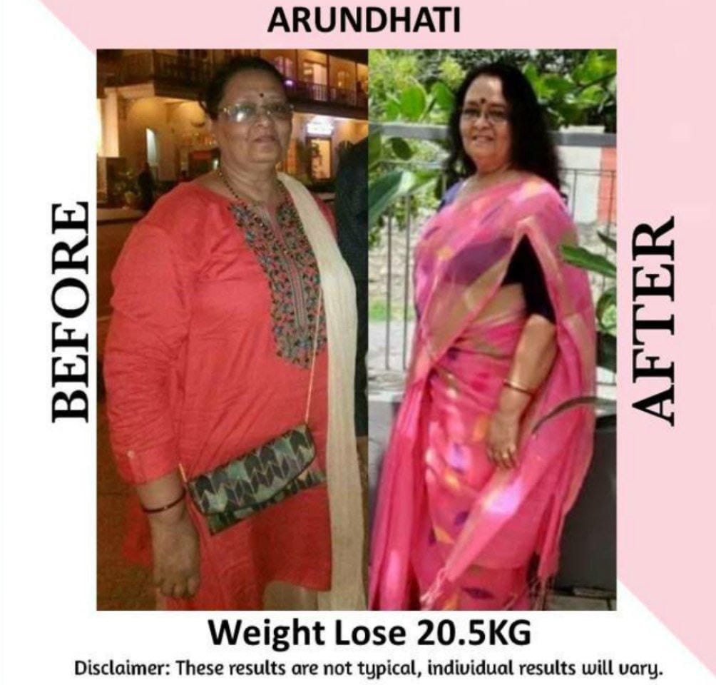 Arundhati — before and after losing 20.5 kg