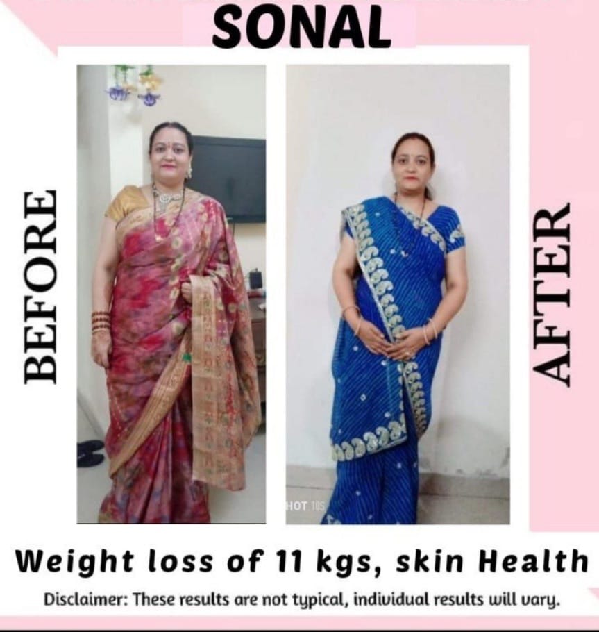 Sonal — before and after losing 11 kg