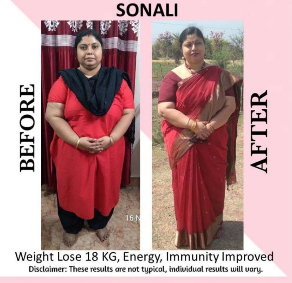 Sonali — before and after losing 18 kg